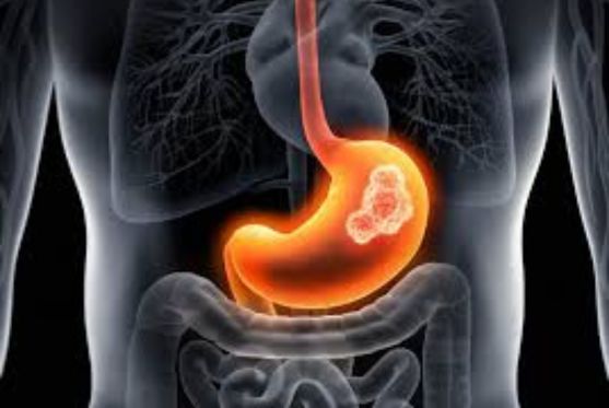Dr. Vijay Bansal - GI & Abdominal Cancer Surgeon in Mohali