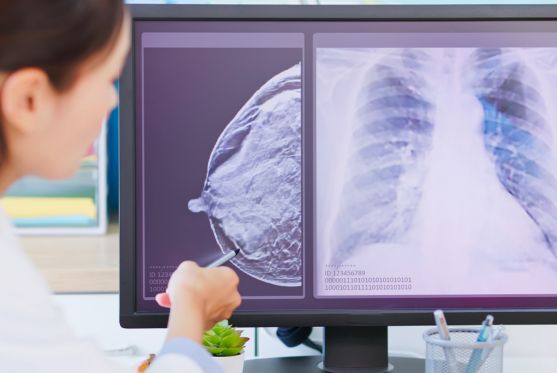 Dr. Vijay Bansal - Breast Cancer Surgeon in Mohali
